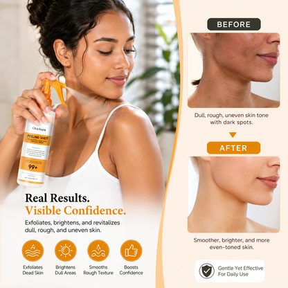 OCEAURA™- Peeling Shot Exfoliating Kojic Acid Turmeric Spray