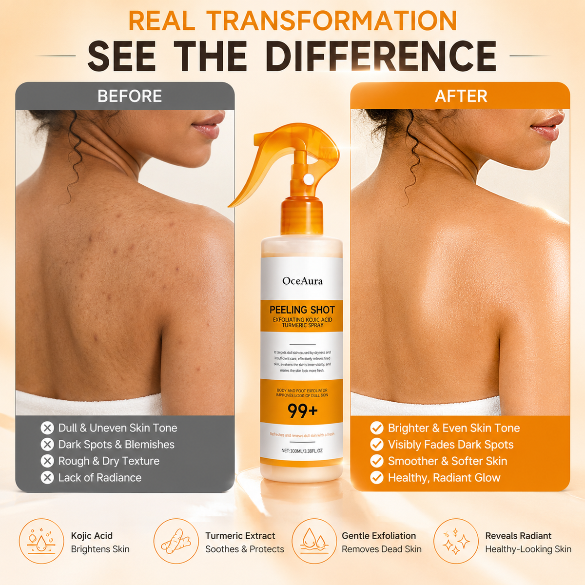 OCEAURA™- Peeling Shot Exfoliating Kojic Acid Turmeric Spray